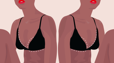 Are You a Good Candidate For Breast Reduction?